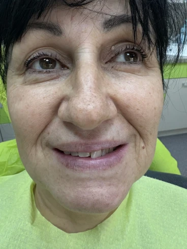 отпечатък за мост