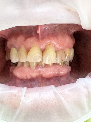 отпечатък за мост