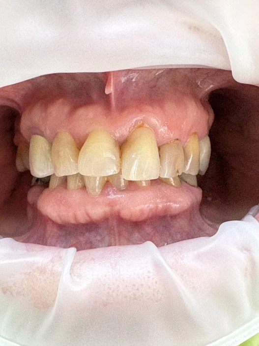 отпечатък за мост отпечатък за мост