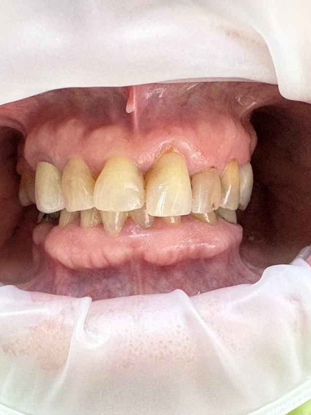 отпечатък за мост - Reservation.Studio