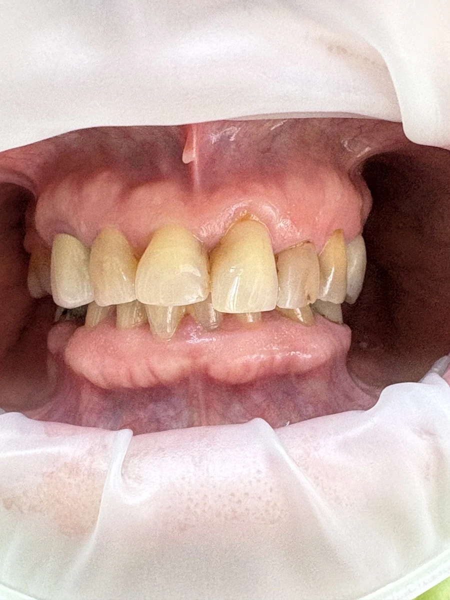 отпечатък за мост - Reservation.Studio отпечатък за мост - Reservation.Studio