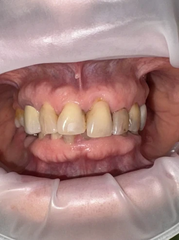 отпечатък за мост