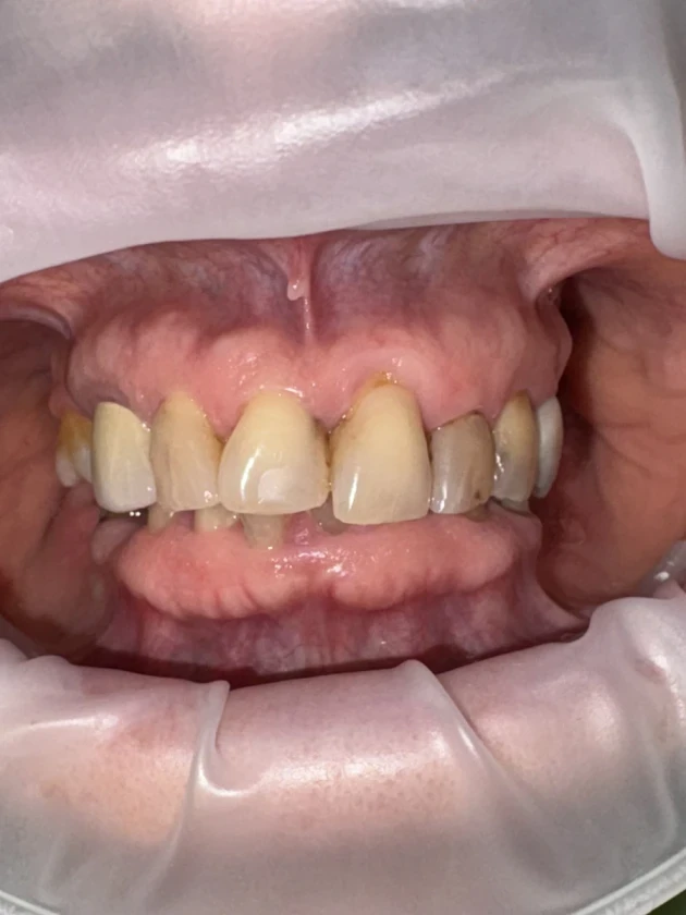 отпечатък за мост - Reservation.Studio