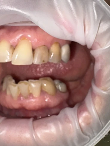 отпечатък за мост