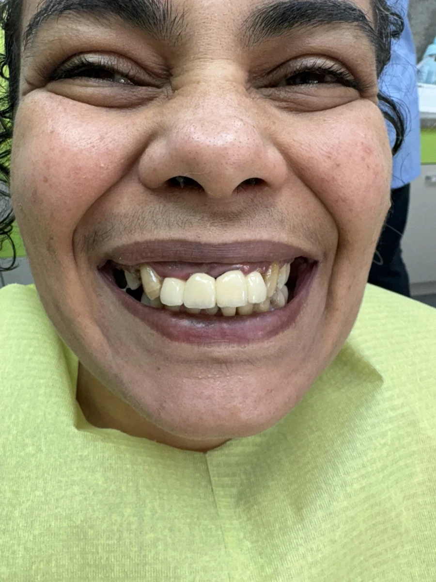 отпечатък за мост - Reservation.Studio