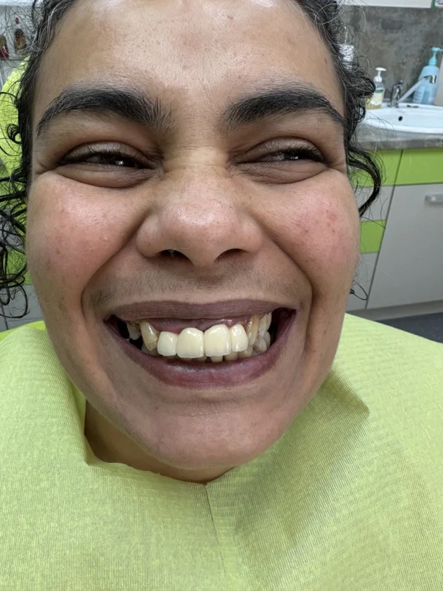 отпечатък за мост - Reservation.Studio отпечатък за мост - Reservation.Studio