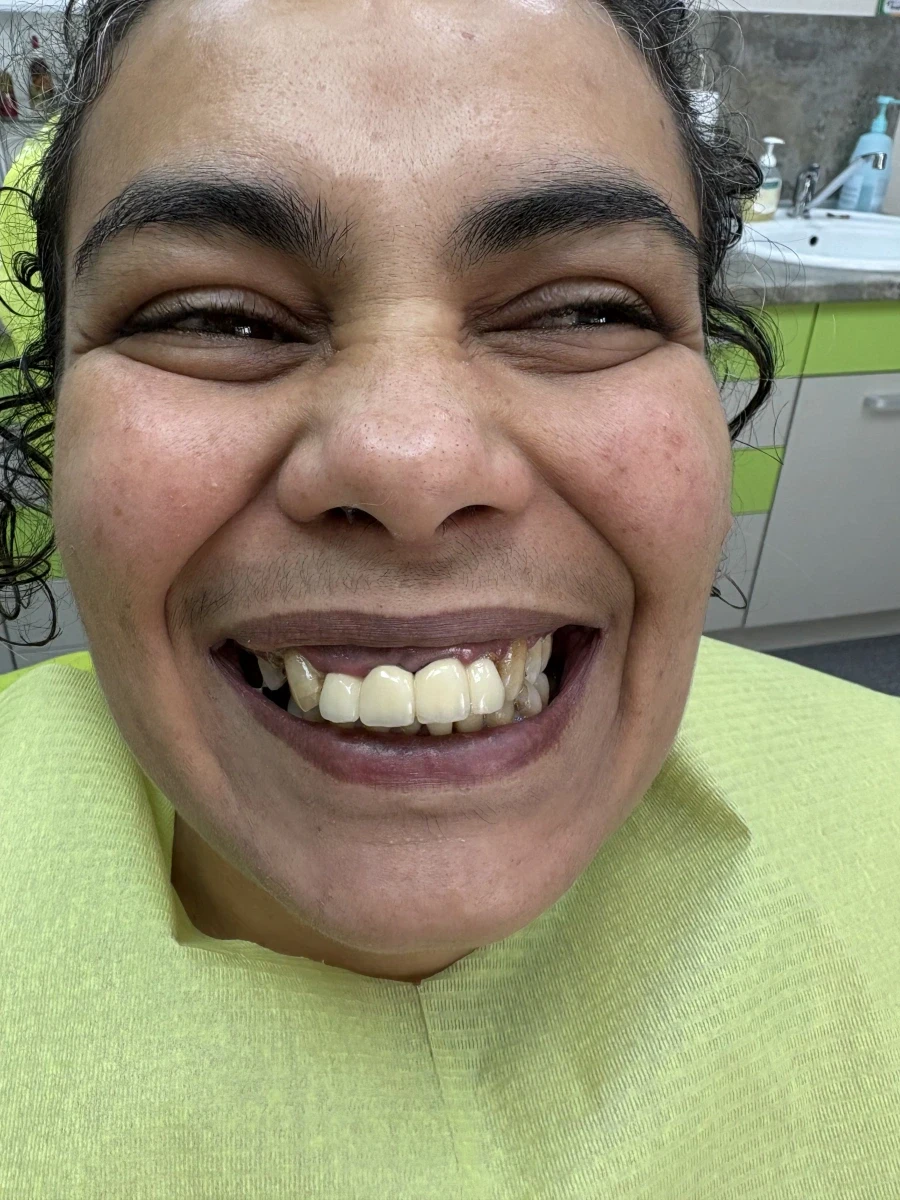 отпечатък за мост - Reservation.Studio отпечатък за мост - Reservation.Studio