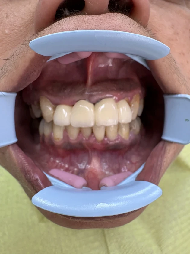 отпечатък за мост - Reservation.Studio отпечатък за мост - Reservation.Studio