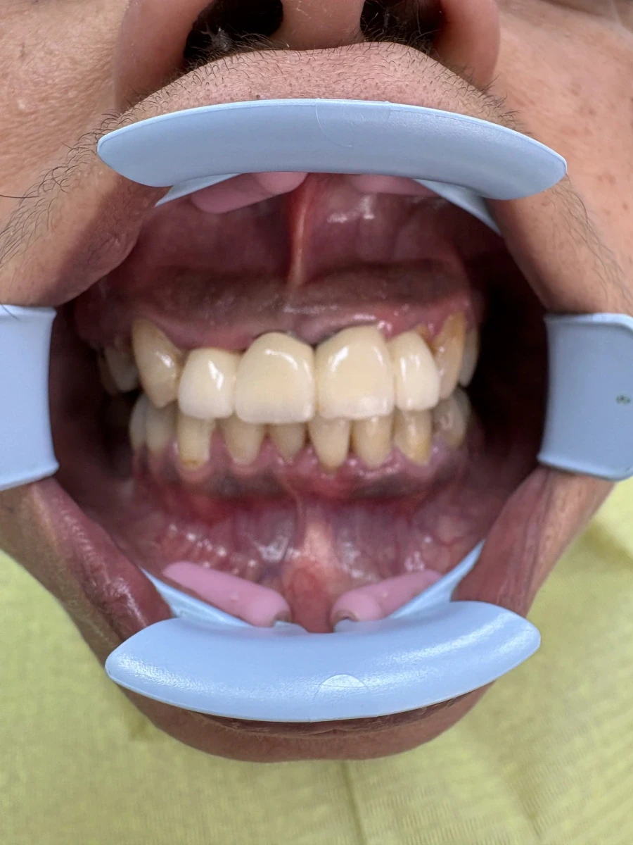 отпечатък за мост - Reservation.Studio