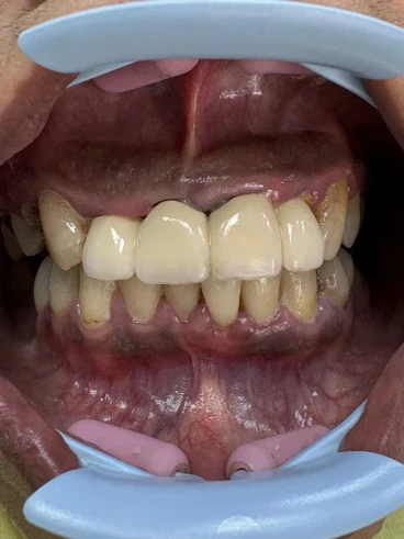 отпечатък за мост