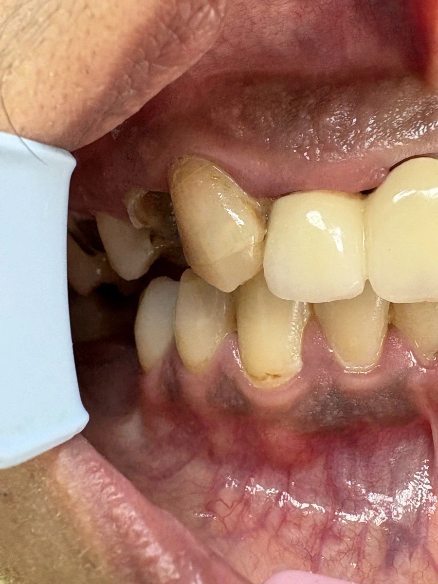 отпечатък за мост - Reservation.Studio