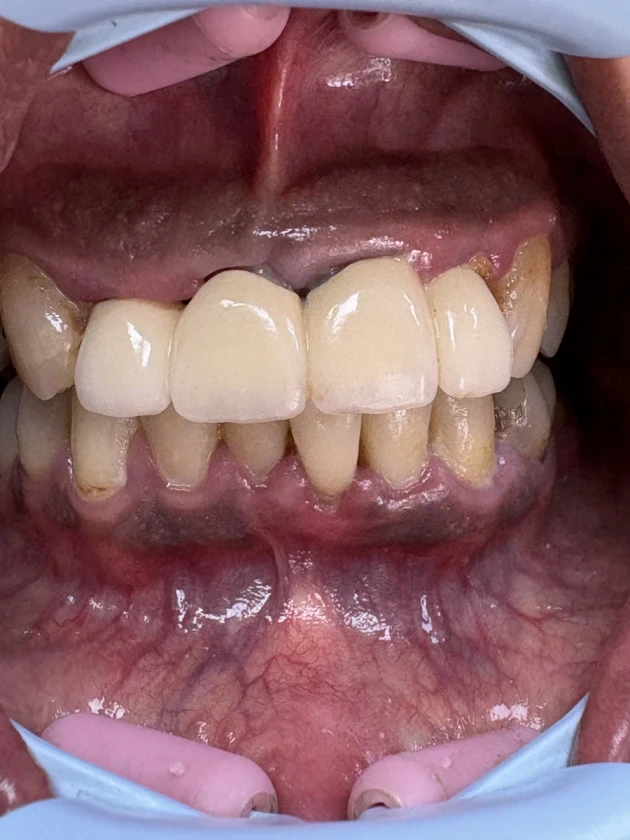 отпечатък за мост - Reservation.Studio отпечатък за мост - Reservation.Studio