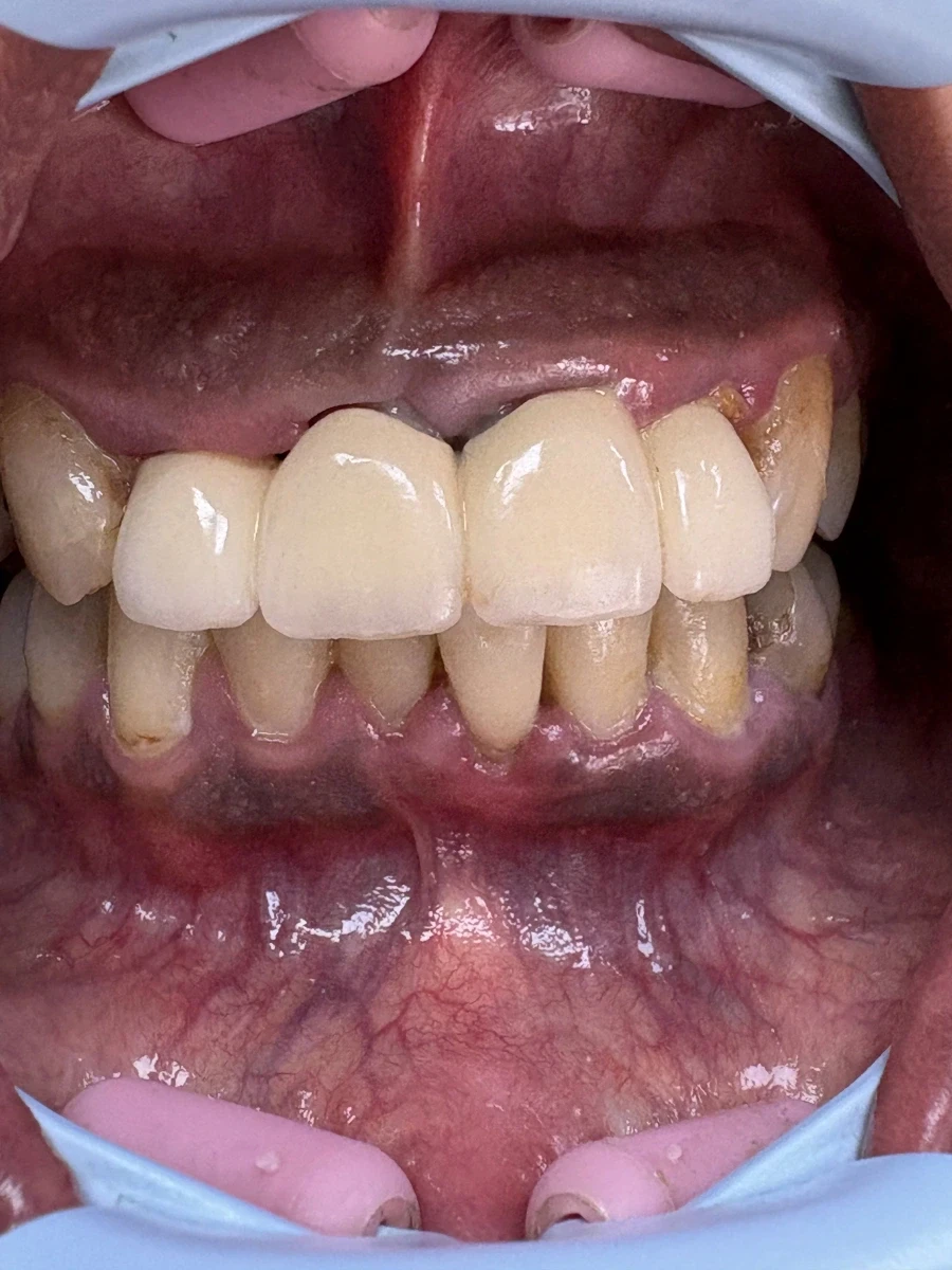 отпечатък за мост - Reservation.Studio