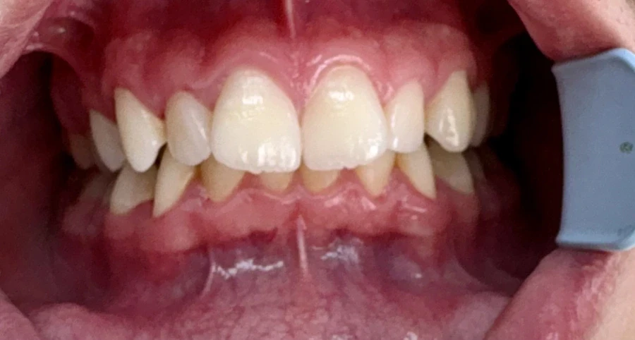 отпечатък за алайнери - Reservation.Studio отпечатък за алайнери - Reservation.Studio