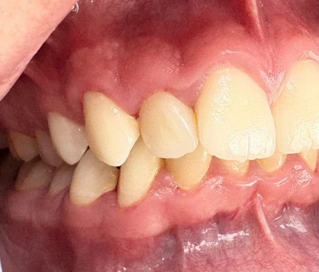 отпечатък за алайнери - Reservation.Studio