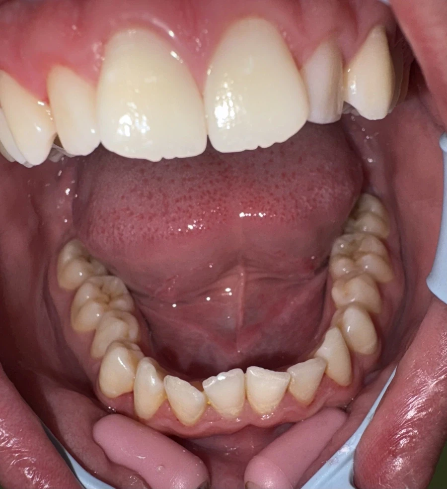 отпечатък за алайнери - Reservation.Studio отпечатък за алайнери - Reservation.Studio