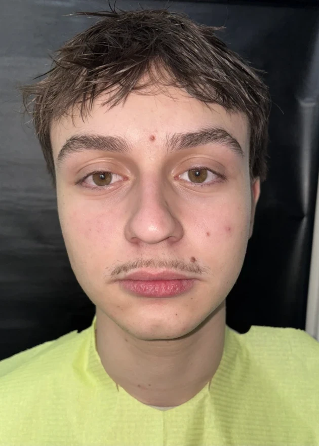 отпечатък за алайнери - Reservation.Studio отпечатък за алайнери - Reservation.Studio