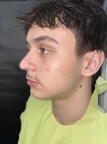 отпечатък за алайнери отпечатък за алайнери