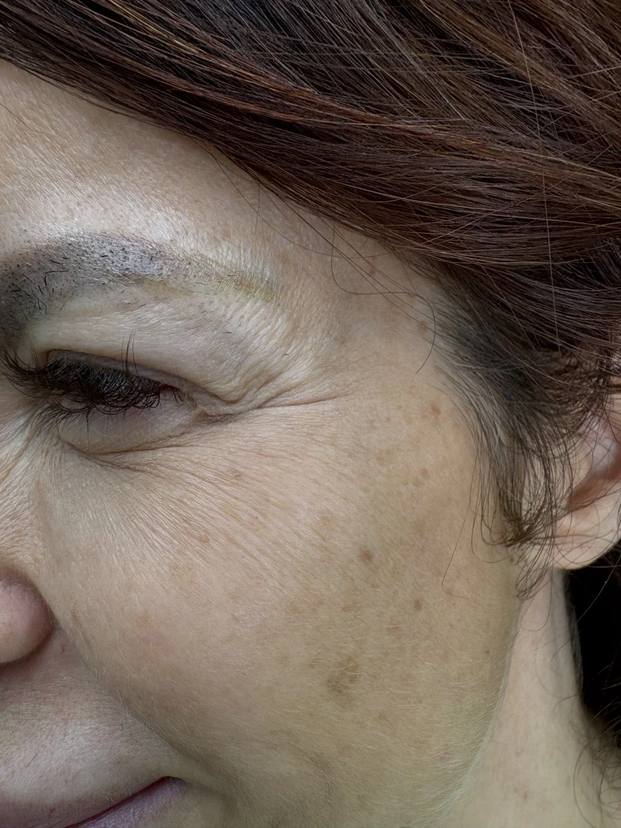 лечение на кариес,обтурация - Reservation.Studio лечение на кариес,обтурация - Reservation.Studio