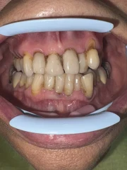 отпечатък за мост отпечатък за мост