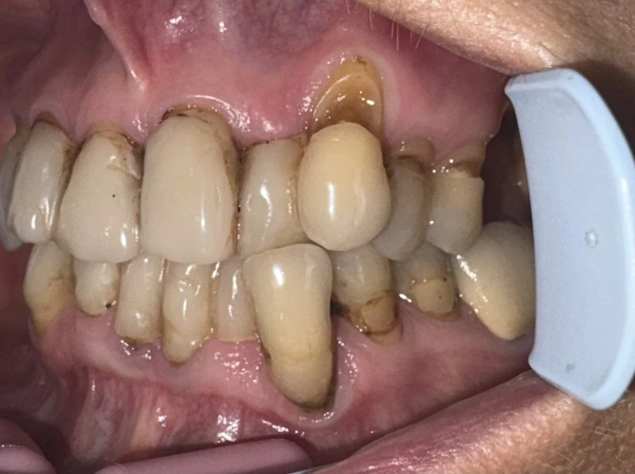 отпечатък за мост - Reservation.Studio