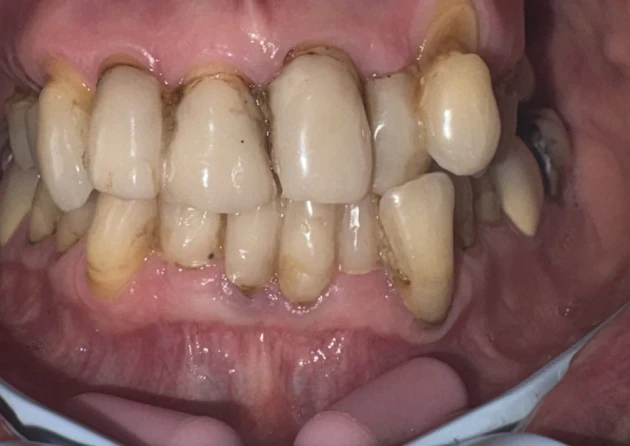 отпечатък за мост - Reservation.Studio