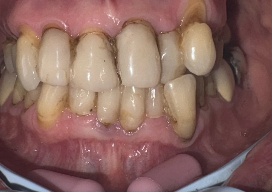 отпечатък за мост - Reservation.Studio