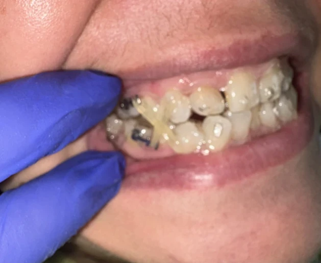 отпечатък за мост - Reservation.Studio отпечатък за мост - Reservation.Studio