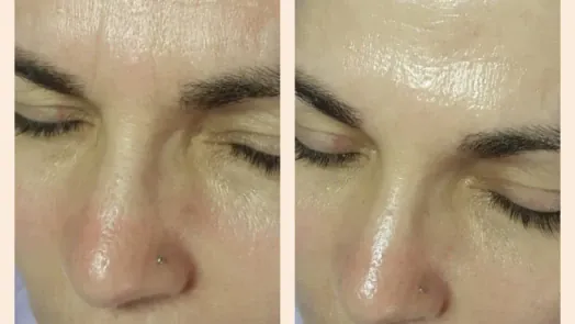 Салон за красота "КОРОНА" Салон за красота "КОРОНА"