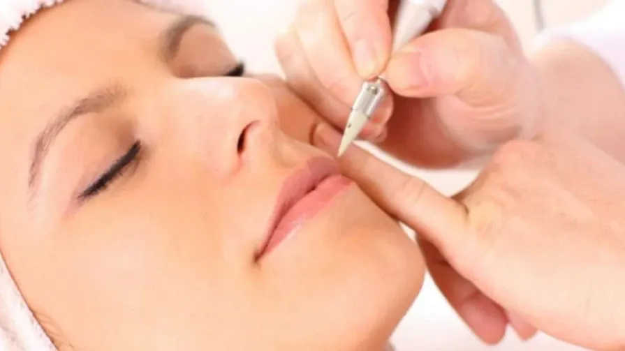 Микродермапигментация Микродермапигментация