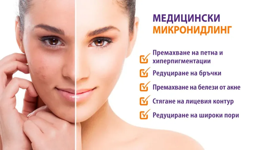 Медицински Микронидлинг Медицински Микронидлинг