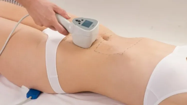 EXILIS EXILIS