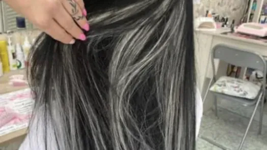 Зашиване с капси Зашиване с капси