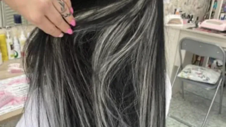 Зашиване с капси Зашиване с капси