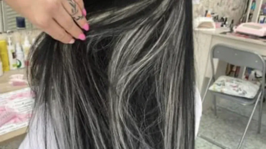 Зашиване с капси Зашиване с капси