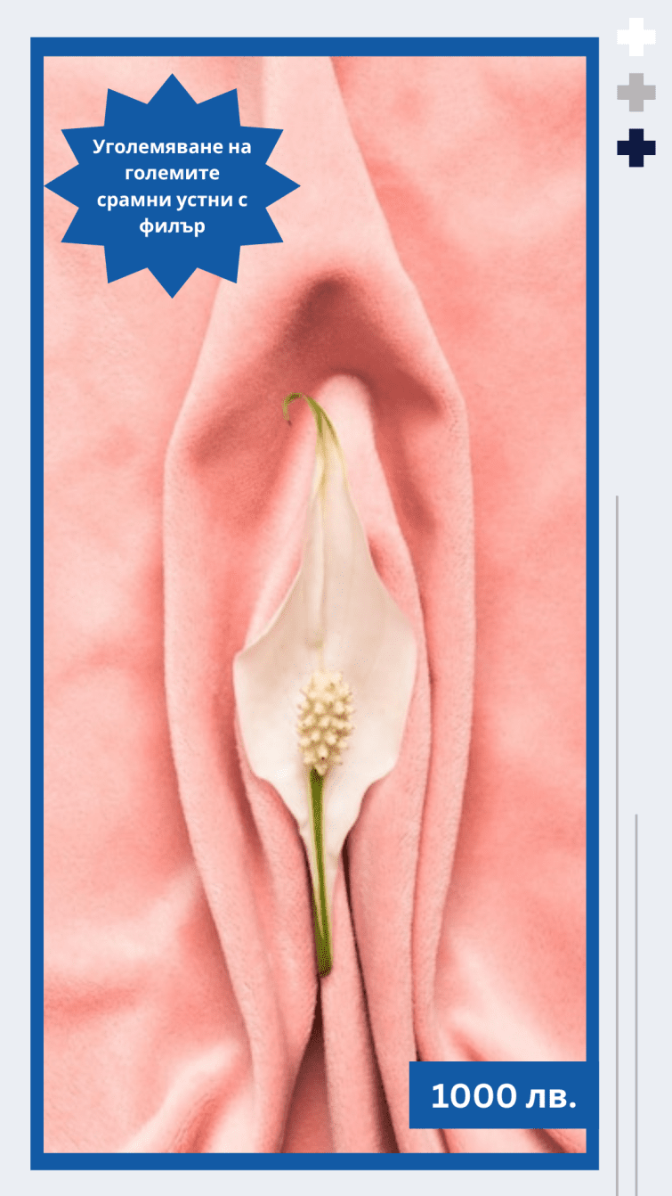 🌸 Büyük dış dudakların hiyaluronik dolgu ile büyütülmesi.