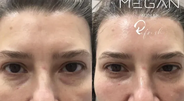 MEGAN - Reservation.Studio