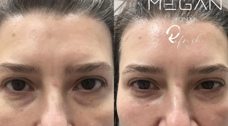 MEGAN - Reservation.Studio