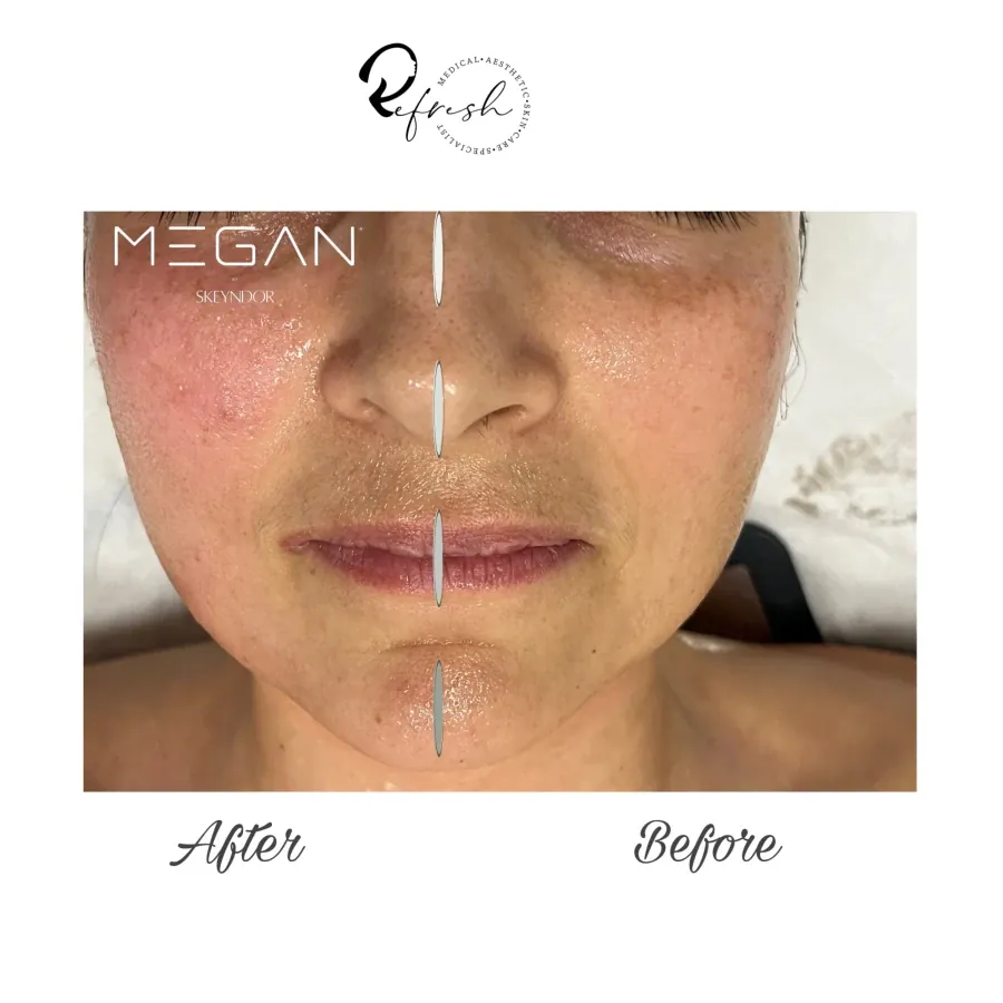 MEGAN - Reservation.Studio