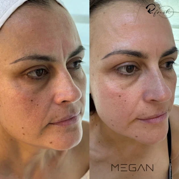 MEGAN - Reservation.Studio MEGAN - Reservation.Studio