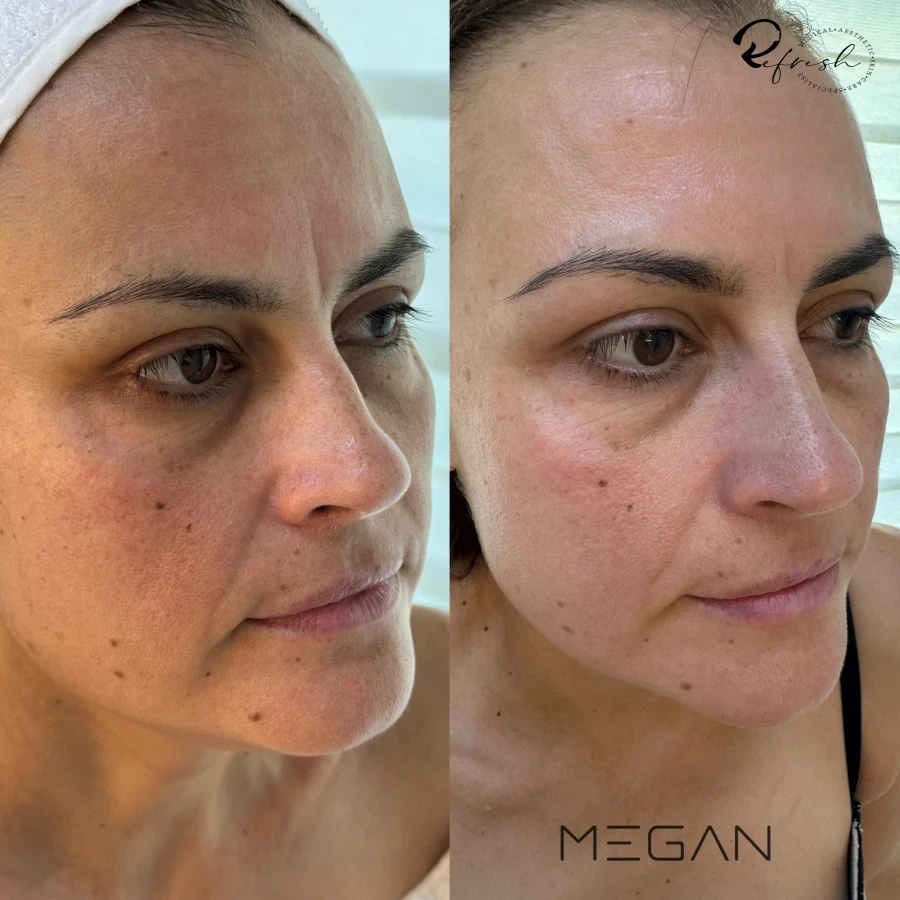 MEGAN - Reservation.Studio MEGAN - Reservation.Studio