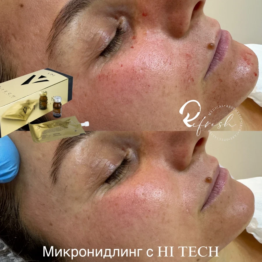 Микронидлинг - Reservation.Studio Микронидлинг - Reservation.Studio